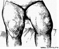 Инфекционные болезни - image01.jpg