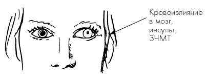 Пока едет «Скорая». Рассказы, которые могут спасти вашу жизнь - i_014.png