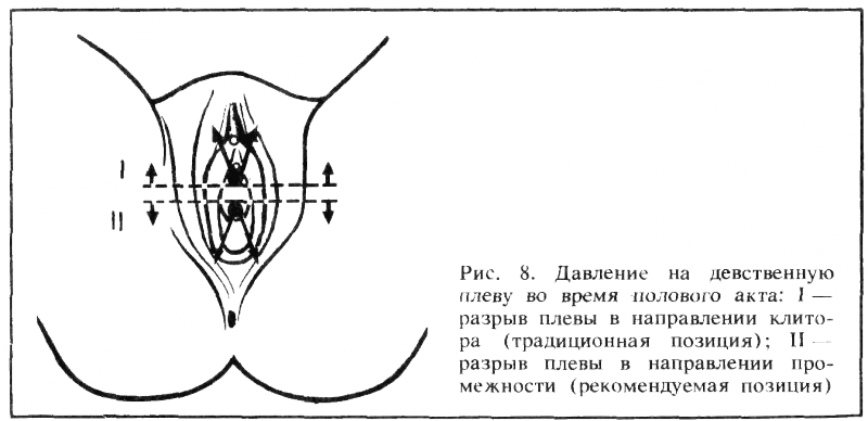 Искусство любви - _8.png