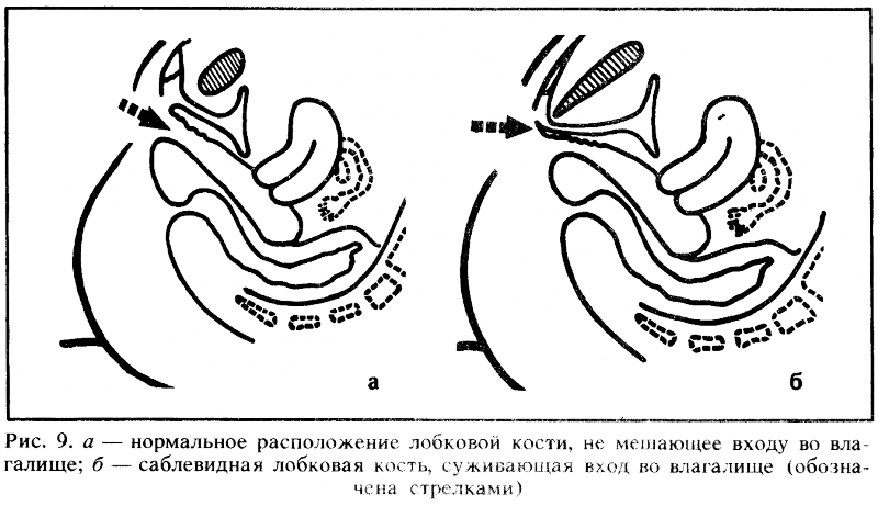 Искусство любви - _9.png