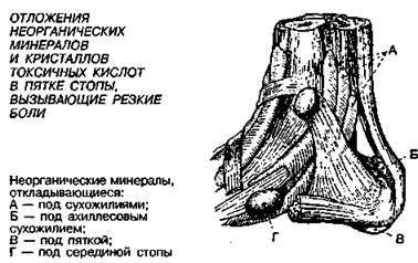 Шокирующая правда о воде и соли - any2fbimgloader39.jpeg