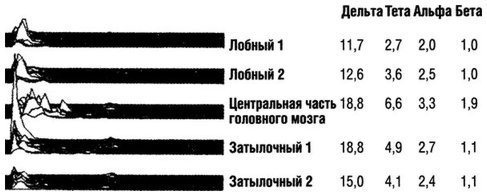 Квантовое Прикосновение: Исцеляющая энергия - i_066.jpg