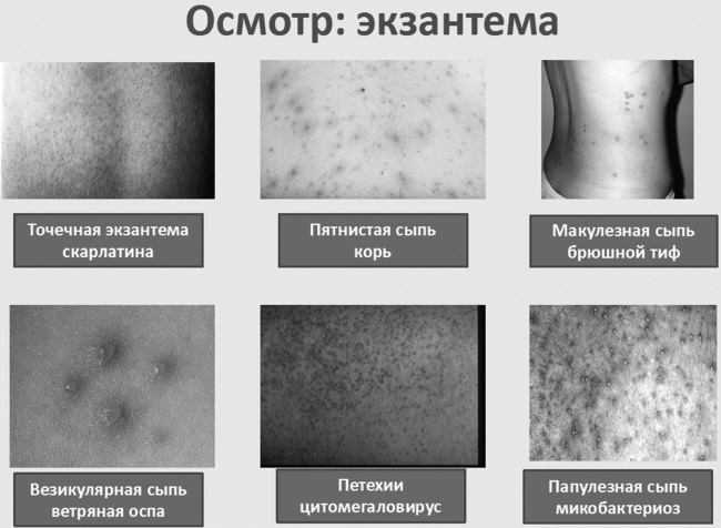 Лихорадка. Руководство для практических врачей - i_004.jpg