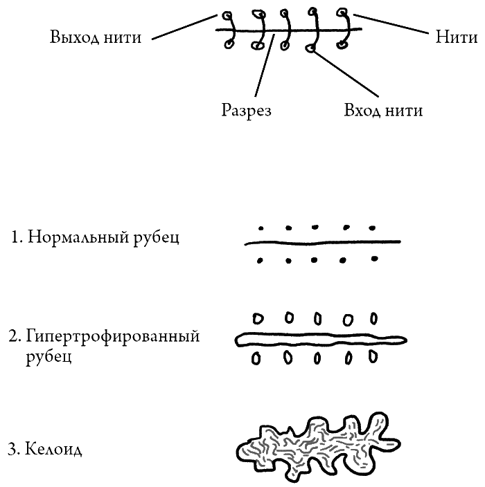 Что скрывает кожа. 2 квадратных метра, которые диктуют, как нам жить - i_008.png