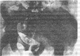 Голографическая Вселенная - image012.jpg